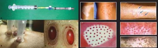 1642753915144404.jpg 干細(xì)胞治療白癜風(fēng)