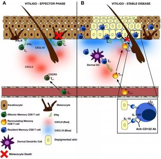 1642754035641601.jpg 干細(xì)胞治療白癜風(fēng)