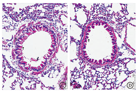 干細(xì)胞存儲(chǔ) 存儲(chǔ)干細(xì)胞選擇漢氏聯(lián)合