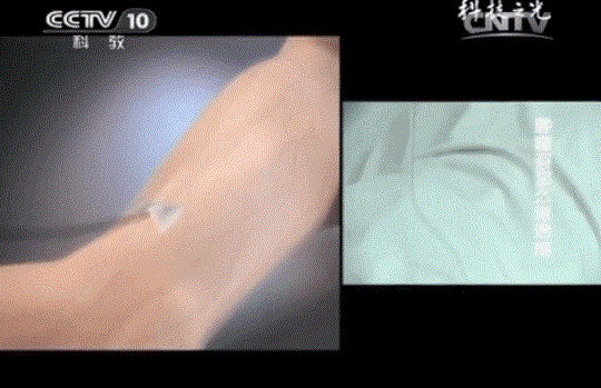 漢氏聯(lián)合可以儲存免疫細胞嗎 漢氏聯(lián)合可以儲存免疫細胞嗎